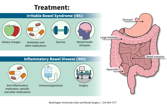 Inflammatory Bowel Disease or Irritable Bowel Syndrome? | Department of ...