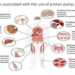 Long-Term Side Effects of Trulicity Explained: A Comprehensive Guide